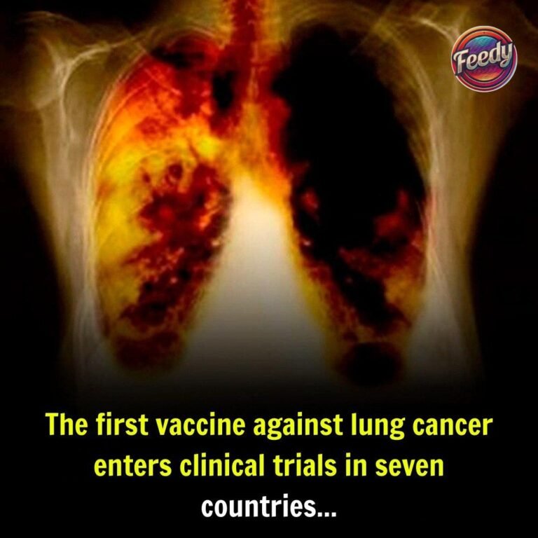 Lung cancer