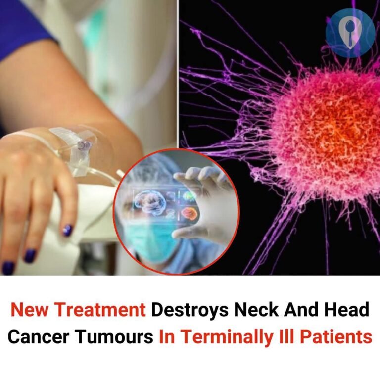 Neck And Head Cancer