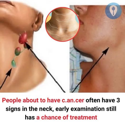 Warning Signs of Cancer