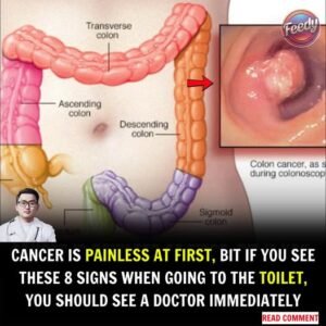 Cancer Diagnosis