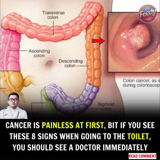 Cancer Diagnosis