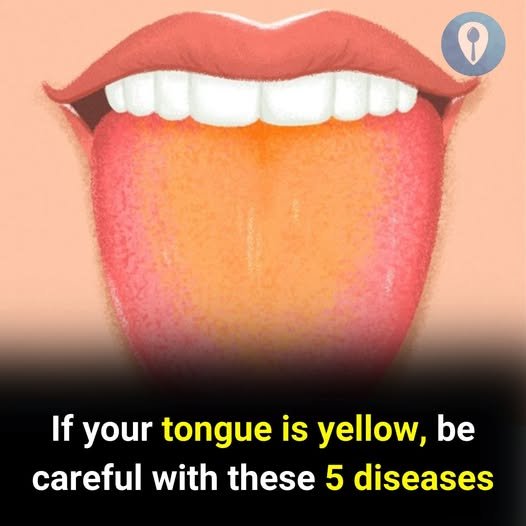 tongue